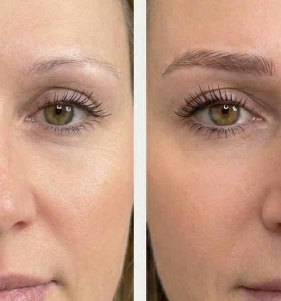 Risultato microblading sopracciglia naturali prima e dopo